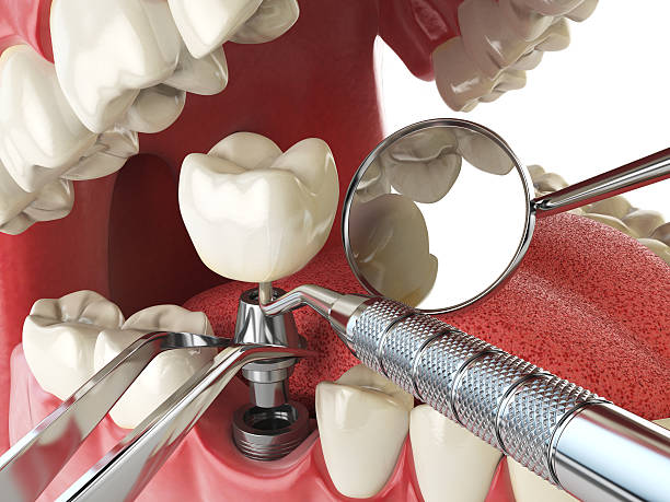 Best Emergency Dental Care for Trauma or Injury in Blue Grass, IA